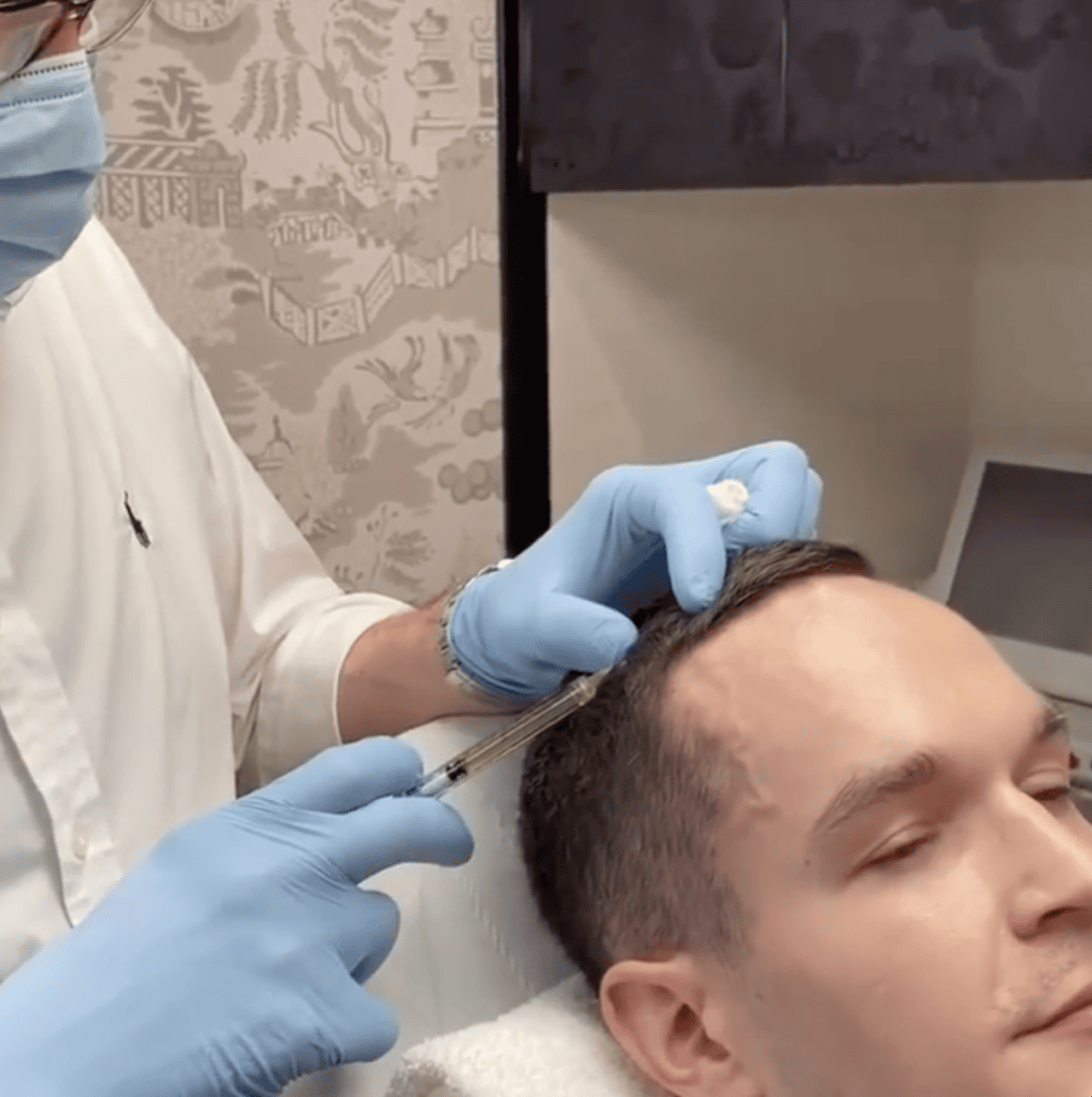 PRP for Hair Loss