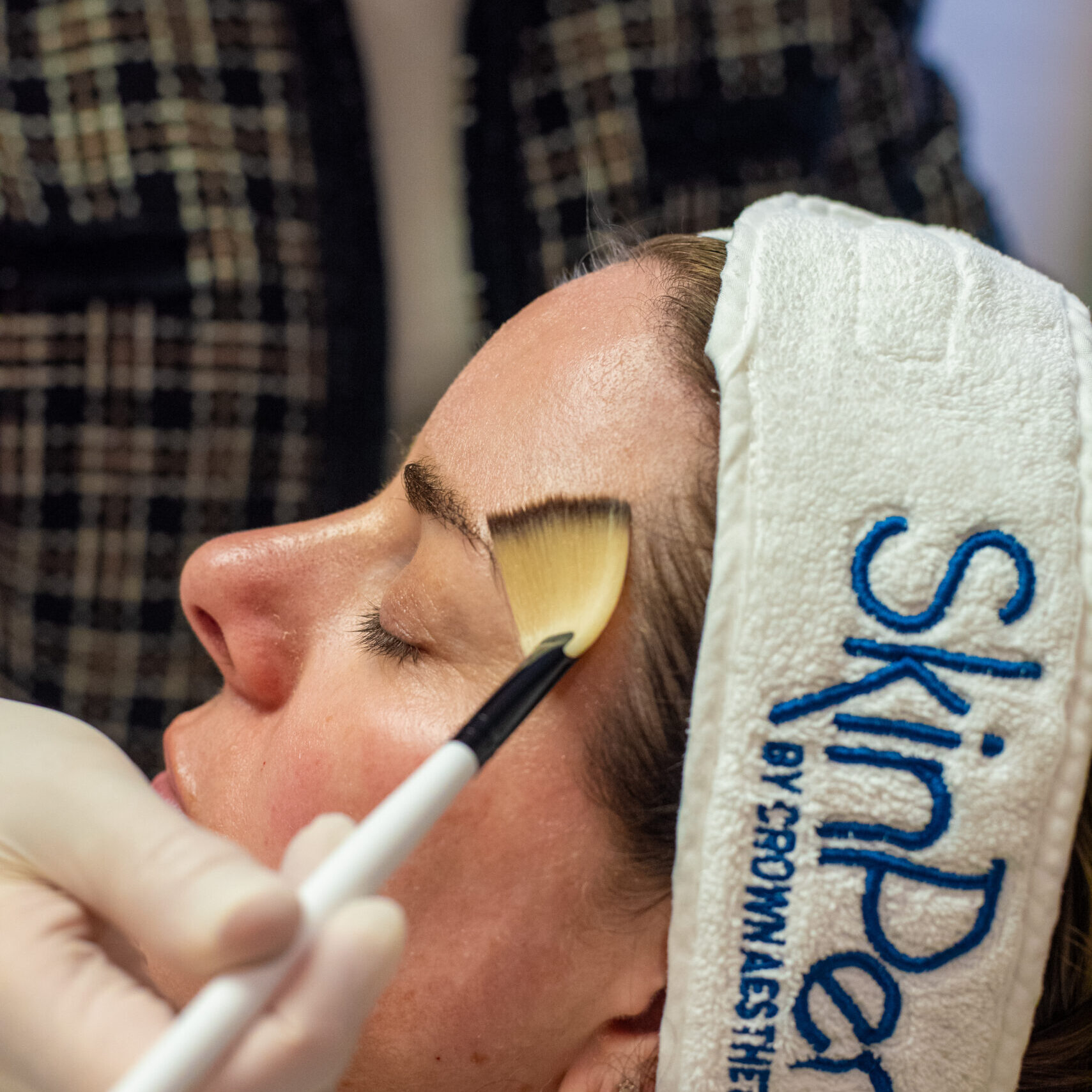 Chemical peels