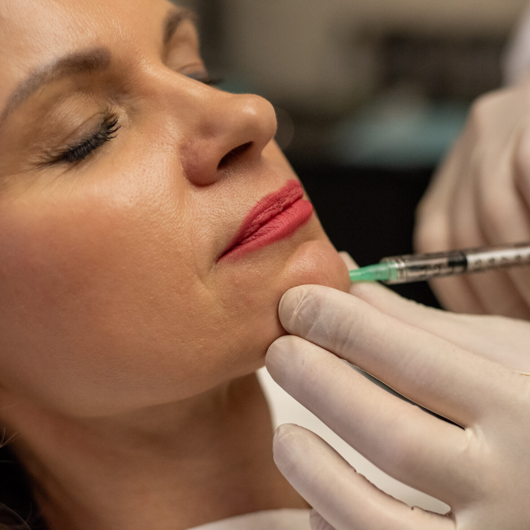 Dermal fillers