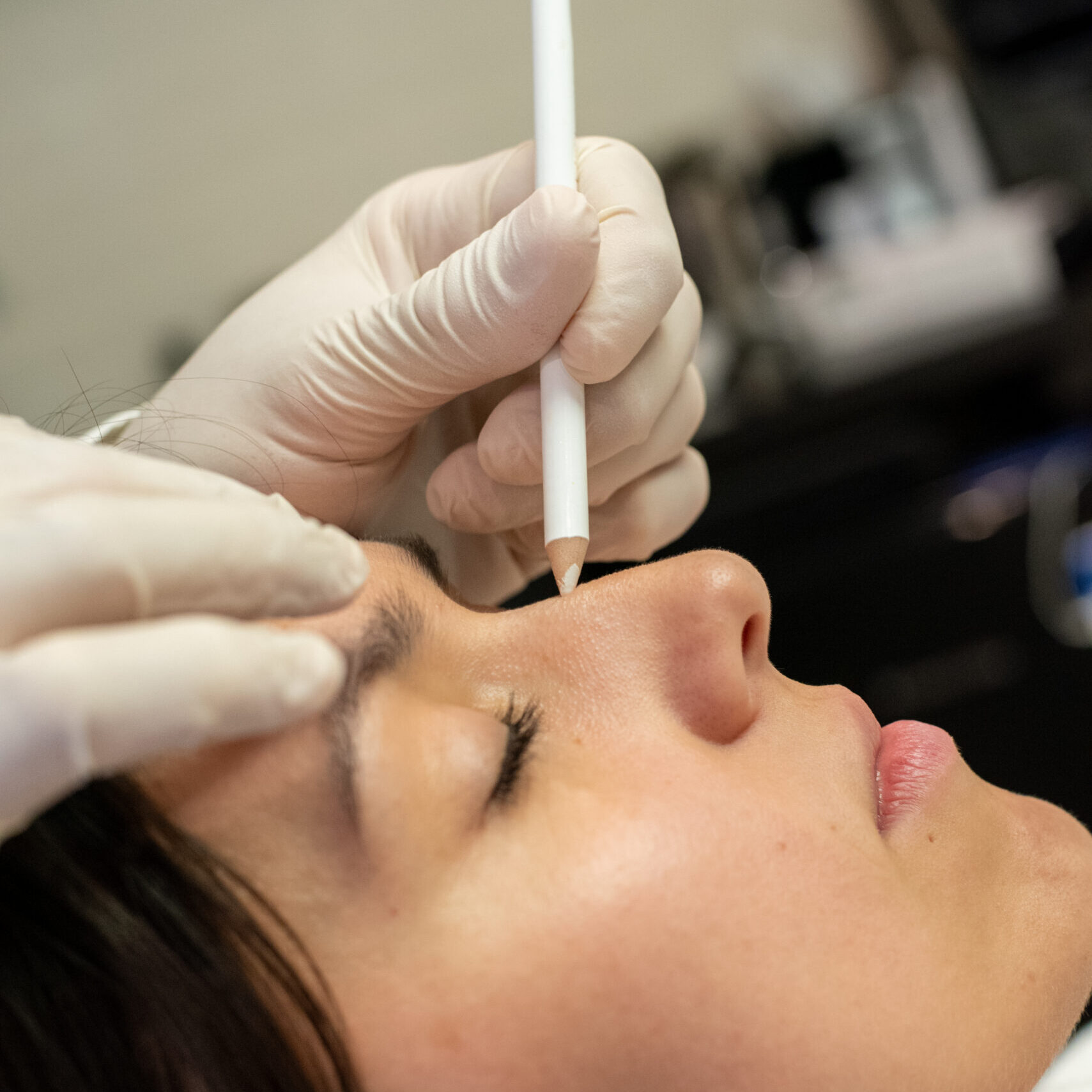 Rhinoplasty