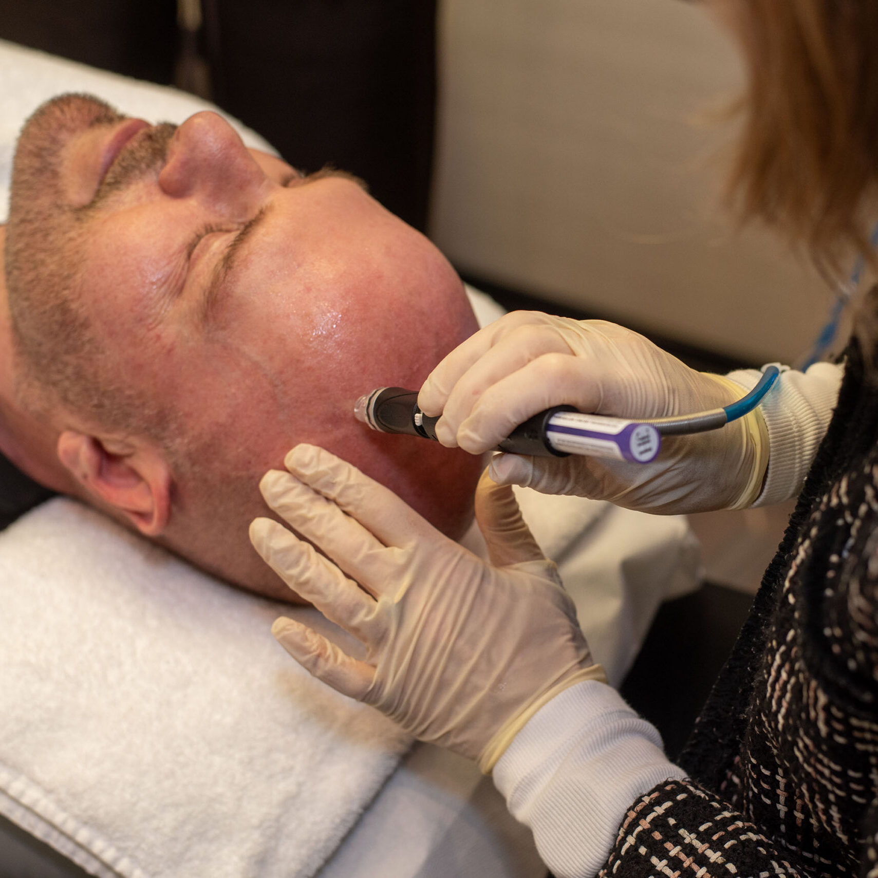 HydraFacial