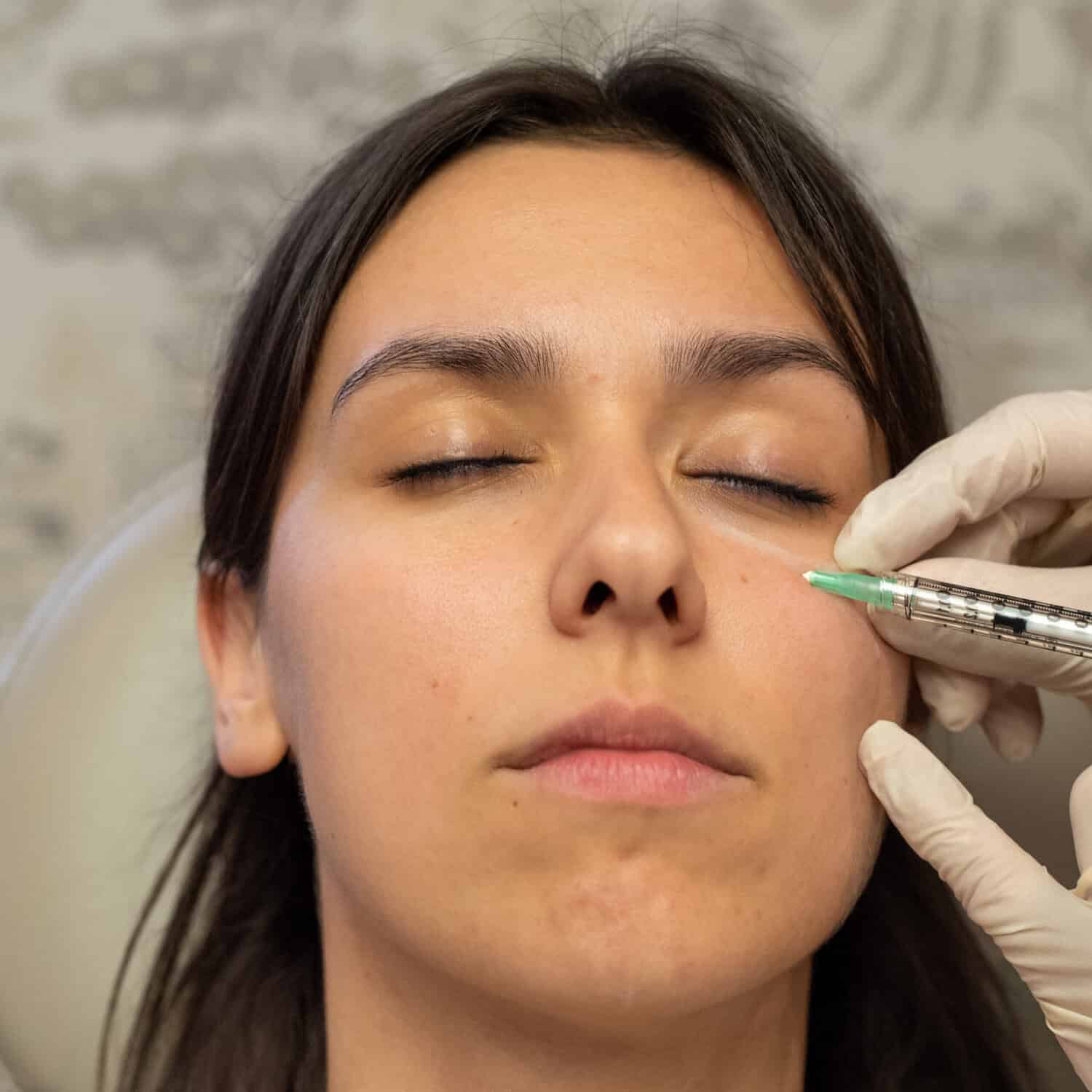 Tear Trough Filler