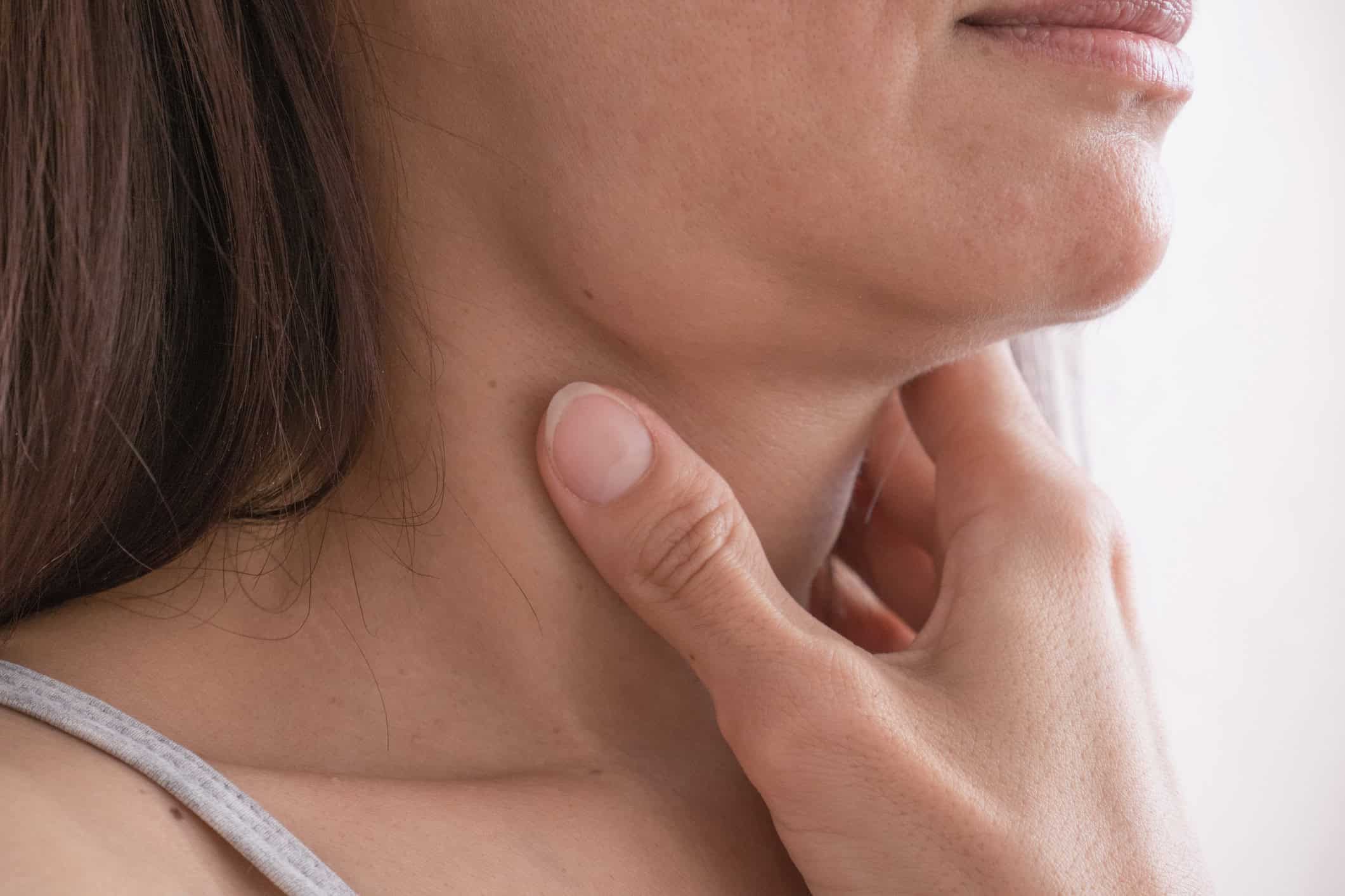 Fullness Under the Chin
