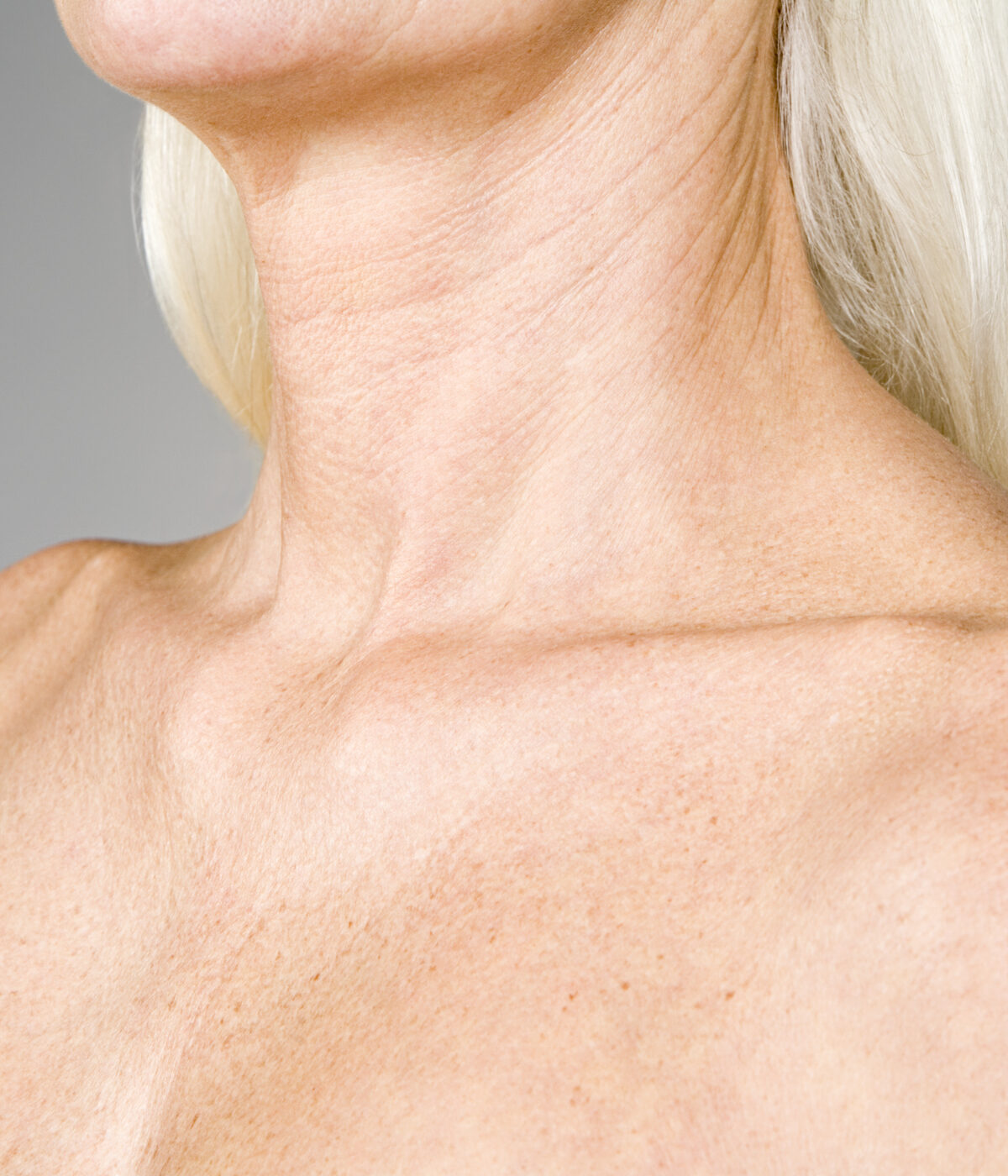 Mottled Chest and Shoulders