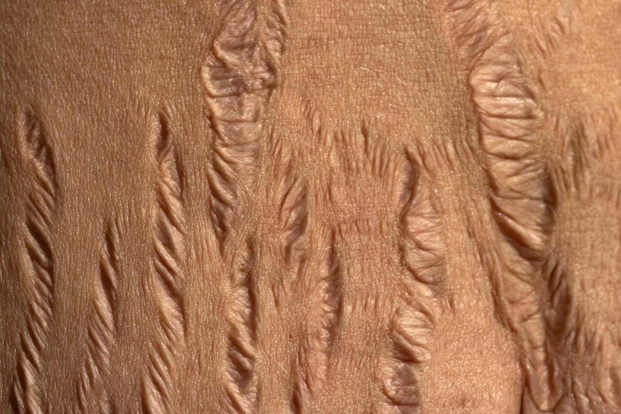 Deep, Wide, Established Marks