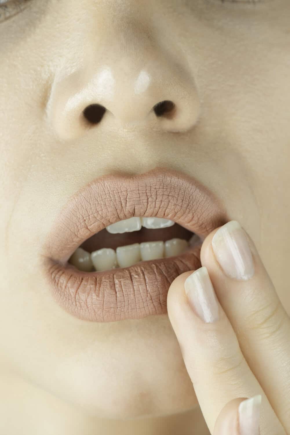 Dry, Crepey Lip Texture