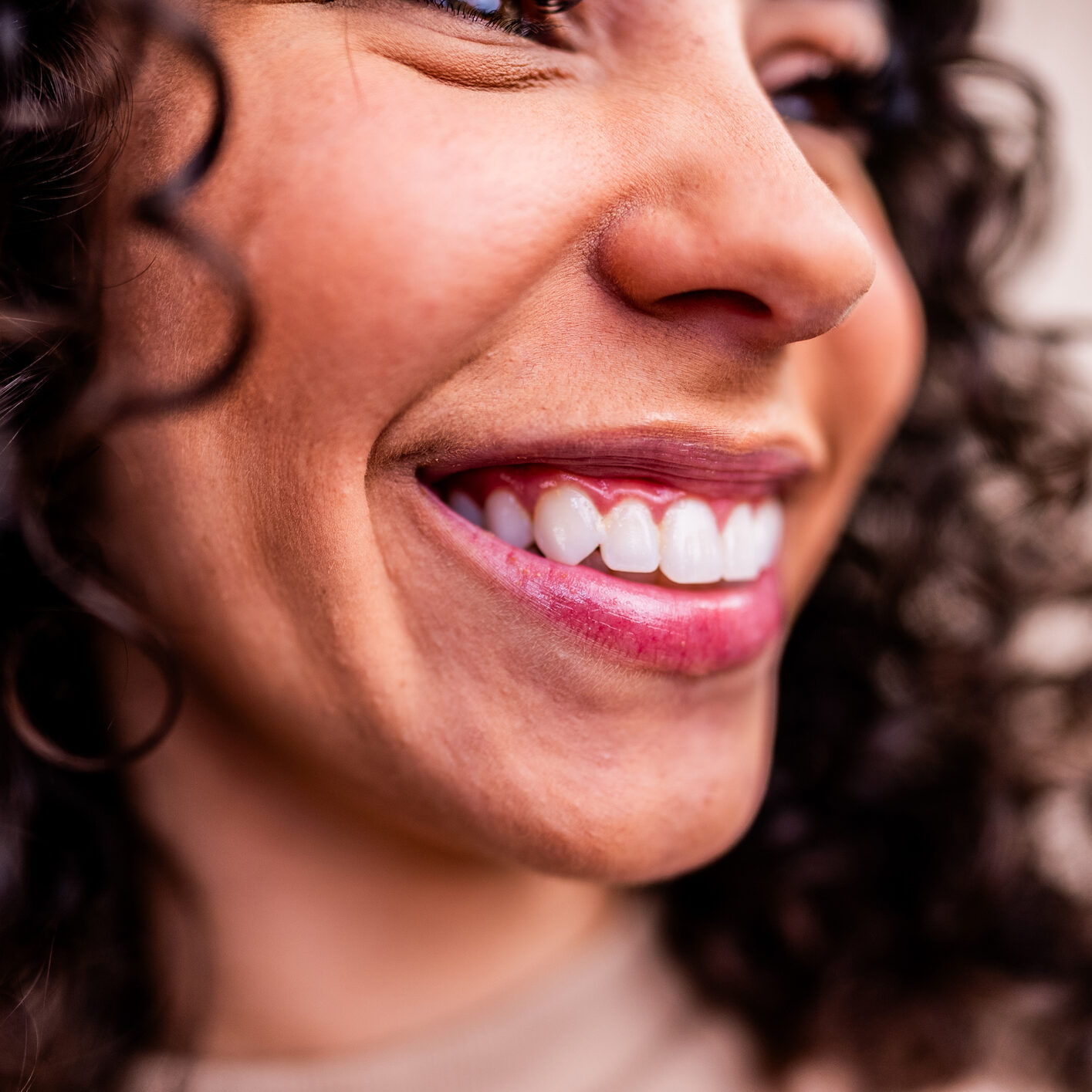 Gum Show With a Thin Upper Lip