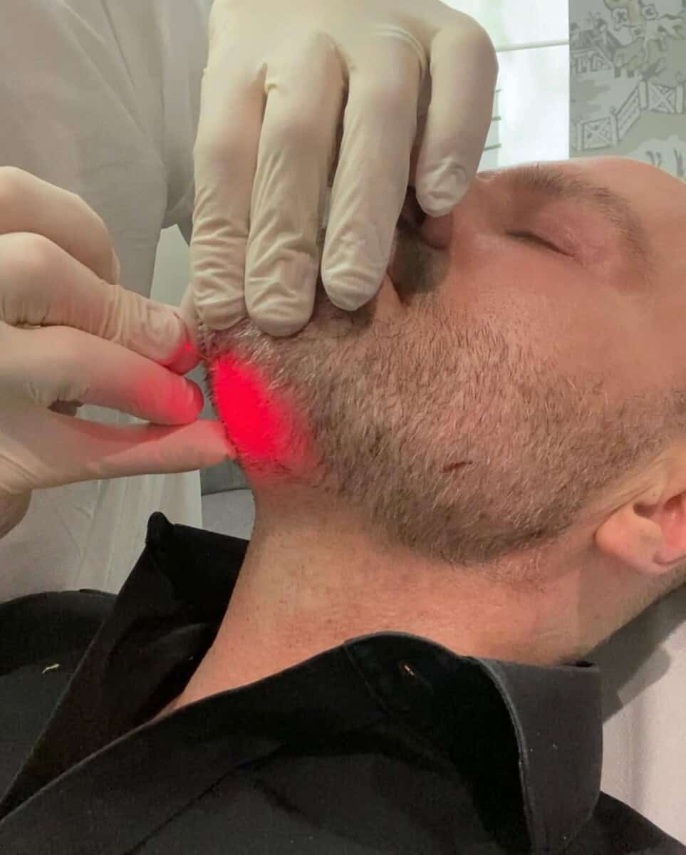 Endolift